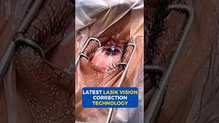 Latest Lasik Vision Correction Technology