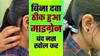 सिरदर्द माइग्रेन बंद नस खोल कर बिना दवा ठीक हुआ ऐसे Dr  Harish Grover chiropractor