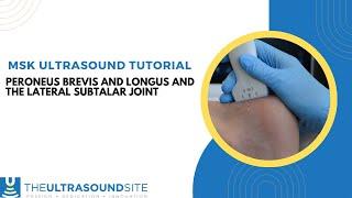 Musculoskeletal ultrasound of Peroneus longus and Peroneus brevis and the lateral subtalar joint.