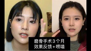 【车笠子】磨骨手术三个月的反馈 来看下变化有多大吧 目前仍存在的后遗症 颧骨颧弓内推 下颌骨截骨