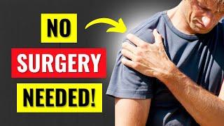 How to Heal a Rotator Cuff Tear Without Surgery (2025)