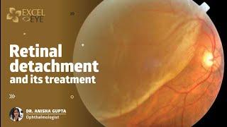 Retinal detachment and its treatment | Dr Anisha Seth Gupta - Eye Specialist in Delhi