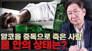 술을 많이 마시면 내 몸 안에서 벌어지는 일!