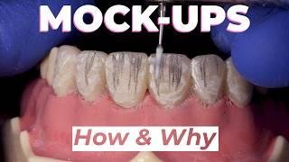 How To: Dental Mock-Ups with Dr. Lincoln Harris