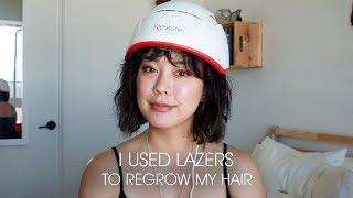 hair regrowth for hair loss and thinning hair | iRestore Professional