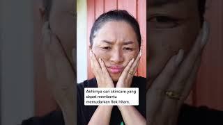 Akibat Pakai Skincare Yang Mengandung Merkuri