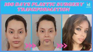 ID Hospital Transformation Series - Kitiana from USA