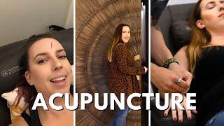 IS MODERN ACUPUNCTURE OPEN? SF BAY AREA ACUPUNCTURE FOR STRESS & BACK PAIN