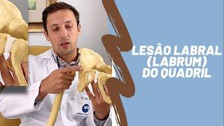 Lesão labral (do labrum) acetabular