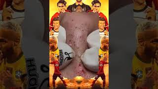 تلميع وتنظيف الجلد الطبيعي المدورNASA168 | Crazy BLACKHEADS REMOVAL #blackheads #shorts #shortvideo