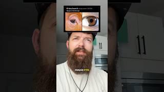 Pig eye VS human eye?? (Crazy to think) #christian #trustgod #godwins