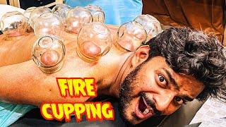 FIRE Cupping Karali  | Hijama Vlog | Muscle Fitness | Mishkat Khan | Therapy