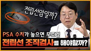 전립선암 진단을 위한 전립선 조직검사, PSA 수치가 높다고 무조건 해야 할까요?