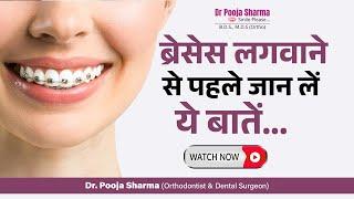 5 Things You Must Know Before Getting Braces | Dental Treatment In Agra, UP - Dr Pooja Sharma