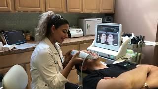 Dr. Naderi gets Ultherapy for Non-surgical Brow Lift