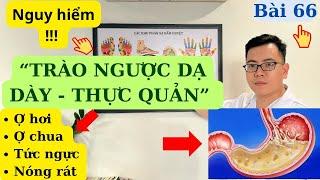 TRÀO NGƯỢC DẠ DÀY THỰC QUẢN, điều chỉnh triệt để không tái lại | Ds Nguyễn Quốc Tuấn