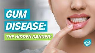 How to Prevent Gum Disease: Essential Tips for Healthy Gums