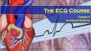 The ECG Course - Junctional Rhythms