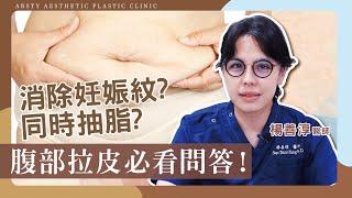 【腹部拉皮常見問題】肚子瘦不下來必看！瘦腹神隊友，腹部拉皮手術沒生產過的人也能做嗎？可以消除妊娠紋嗎？︳產後恢復專業 楊善淳醫師