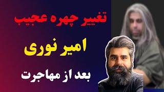 تغییر چهره عجیب و شوکه کننده امیر نوری بعد از مهاجرت