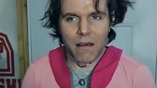 Onision FAILS At Tiktok Livestreaming