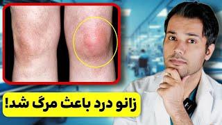 زانو دردی که منجر به یک تشخیص شوکه کننده شد️علت ترسناک زانو درد این بیمار چی بود؟