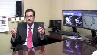 Do aneurysms cause headaches? | Norton Neuroscience Institute