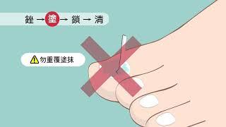 【衛教】灰趾甲用藥指導 (國語)