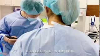 Sydney Ciao Beauty - Dr WU Liposuction_Arms 微创抽脂手术-手臂