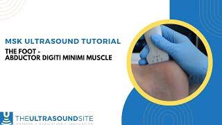 MSK ultrasound evaluation of the abductor digiti minimi muscle