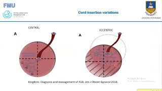 Ultrasound Assessment of the Placenta - Dr Verenga