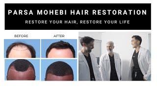 Restore Your Hair at Parsa Mohebi Hair Restoration (LA/SF)