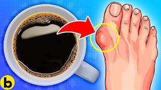 EAT This, NOT This If You Have Gout