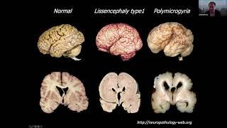 Dr. Zoltán Molnár: "Repurposed Cells Of Development In The Adult Brain”.