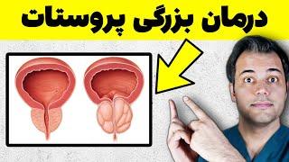 چند راه درمان بزرگی پروستات که لازمه بدونید | بزرگی خوش‌خیم پروستات