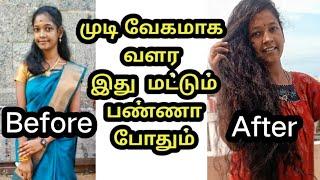 காடு மாதிரி வேகமா முடி வளரும் | fast hair regrowth | homemade | nature | Tamil | AP |