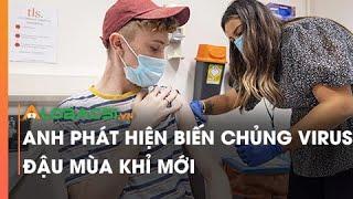 Anh phát hiện biến chủng virus đậu mùa khỉ mới
