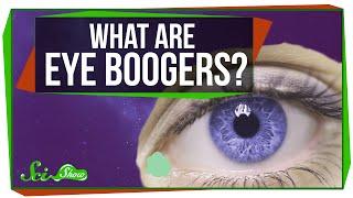 What Are Eye Boogers?