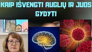 Sveikata | Kaip išvengti auglių ir juos gydyti