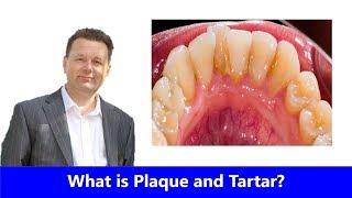 What is Plaque and Tartar?