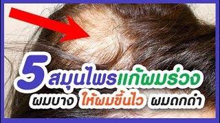 5 สุดยอดสมุนไพรแก้ผมร่วง ผมบาง ให้งอกใหม่เร็วขึ้น ผมดกดำ 5 top herbs to treat hair loss, thin hair.