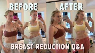 BREAST REDUCTION Q+A