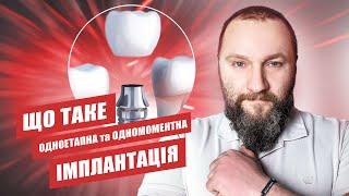  Що таке одномоментна імплантація зубів