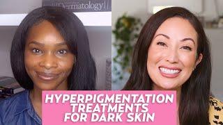 Hyperpigmentation in Dark Skin Tones: A Dermatologist Shares Skincare Tips & Treatments!