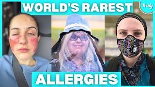 The World's Rarest Allergies | BORN DIFFERENT