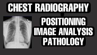 CHEST X-RAY I CHEST RADIOGRAPHIC POSITIONING, IMAGE ANALYSIS, PATHOLOGY - PART 1