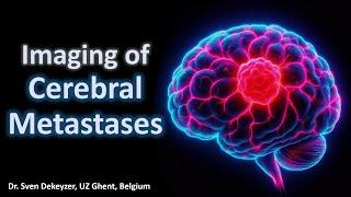 Imaging of cerebral metastases