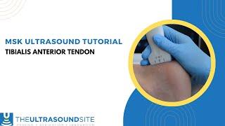 MSK ultrasound of the tibialis anterior tendon