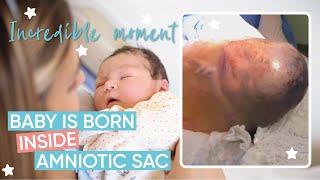 Incredible En Caul Birth | Channel Mum