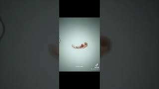 How invitro fertilization works